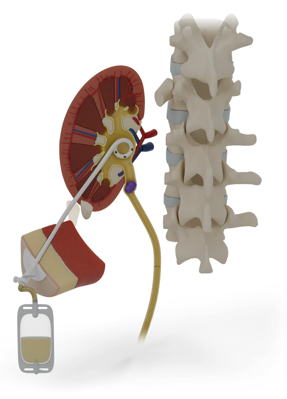 Nephrostomy tube model, hero view.
