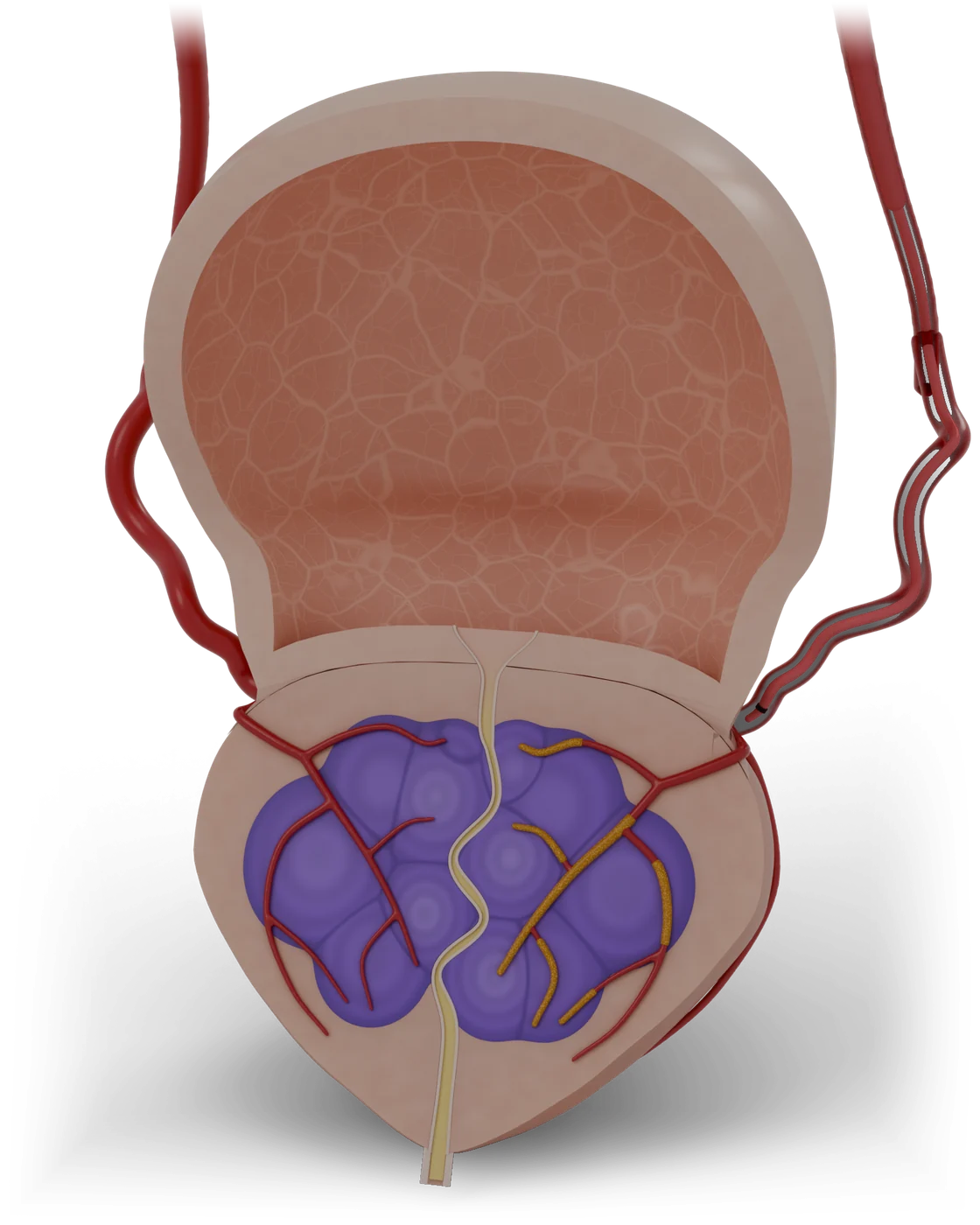 Prostate artery embolization model, detail view.