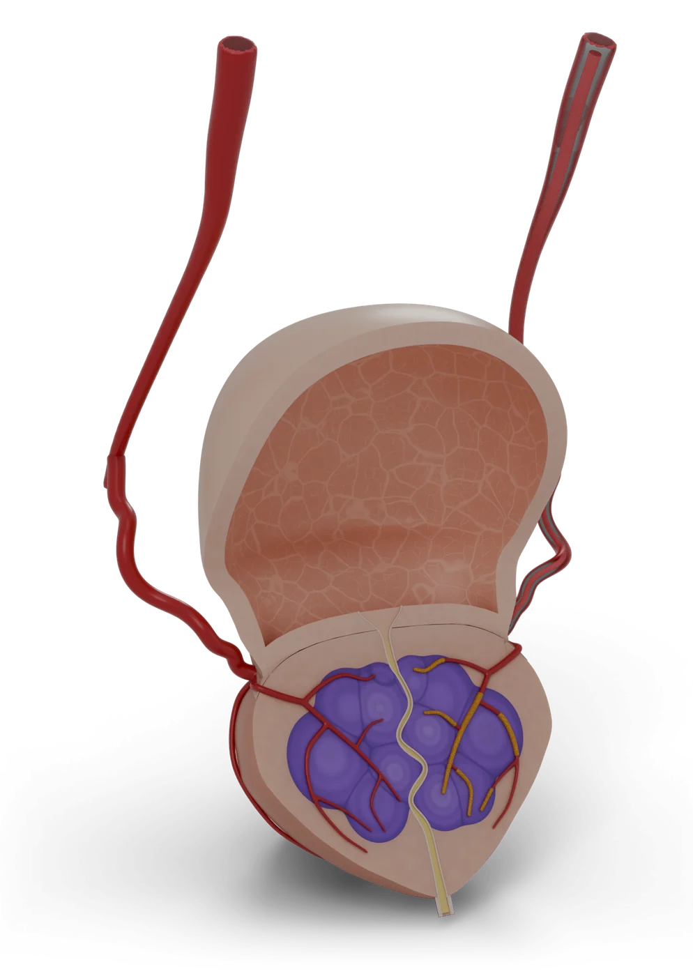 Prostate artery embolization model, hero view.