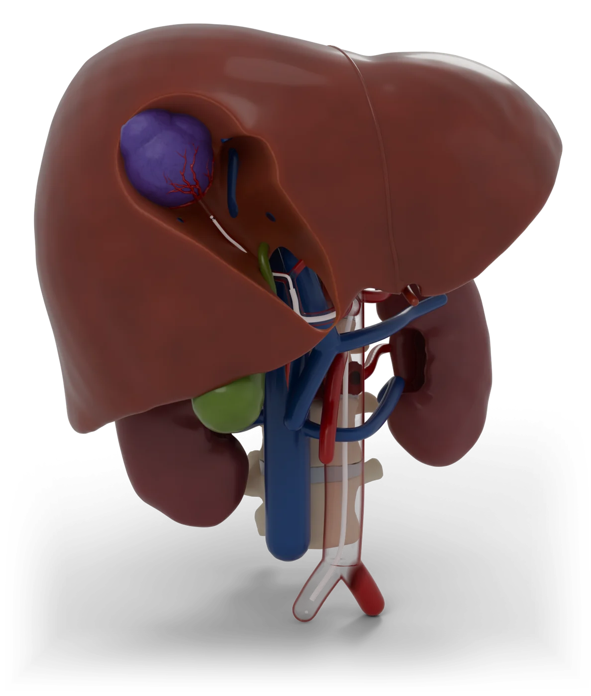 Chemoembolization of the liver model, hero view.
